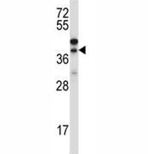 Western blot testing of CTGF antibody and NCI-H460 lysate. Predicted/observed molecular weight ~38kD