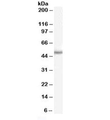 Western blot testing of mouse eye lysate with PAX6 antibody at 0.5ug/ml. Predicted molecular weight 