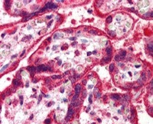 NEIL1 Antibody