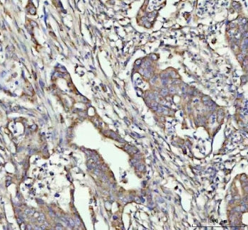 Granulocyte-Colony Stimulating Factor Antibody / CSF3