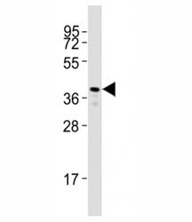 Rhodopsin Antibody / Zebrafish, 0.08ml