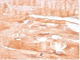 IHC staining of FFPE human skeletal muscle tissue with DMD antibody (clone DMD/3676). HIER: boil tis