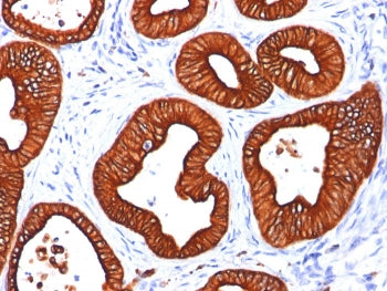 Cytokeratin 18 Antibody