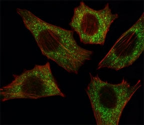 B-RAF Antibody