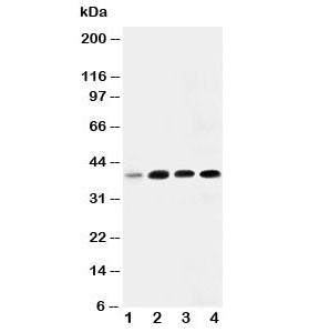 Western blot testing of IGFBP3 antibody and Lane 1: 293T; 2: MCF- 7; 3: A549; 4: SW620. Expected mol