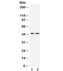 Western blot testing of human 1) HeLa and 2) 22RV1 cell lysate with CTSK antibody. Predicted molecul