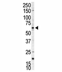 Western blot analysis of p70 S6 Kinase beta antibody and A375 cell lysate. Predicted molecular weigh
