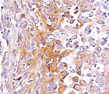 PMEL17 / Melanoma gp100 Antibody