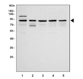 Western blot testing of 1) human HeLa, 2) human Caco-2, 3) human Jurkat, 4) human COLO-320 and 5) ra