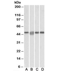 Western blot testing of Daudi [A], Jurkat [B], K562 [C] and MOLT4 [D] lysates with MAP2K2 antibody a
