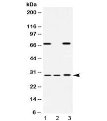 Western blot testing of 1) rat liver, 2) mouse spleen and 3) human HeLa lysate with PSMA4 antibody a
