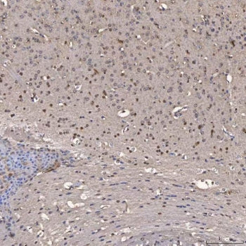 IHC staining of FFPE mouse brain tissue with NOB1 antibody. HIER: boil tissue sections in pH8 EDTA f