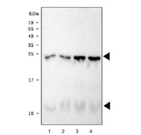 Phospholamban Antibody / PLN