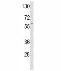 tPA Antibody / Tissue Plasminogen Activator