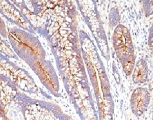 CEA Antibody / Carcinoembryonic Antigen