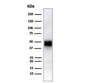 Western blot testing of human Jurkat cell lysate with recombinant CD5 antibody (clone rC5/6429). Obs