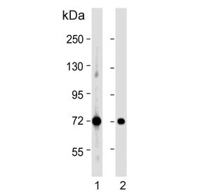 Pyruvate Dehydrogenase E2 Antibody / DLAT