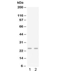 Western blot testing of 1) mouse lung and 2) mouse spleen lysate with Gro gamma antibody. Predicted 