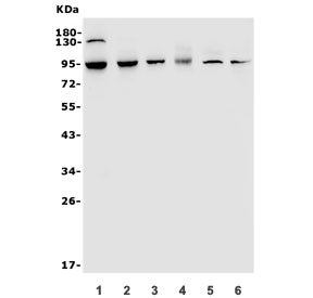 TRPV2 Antibody