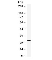 Western blot testing of human placenta lysate with Elafin antibody. Predicted molecular weight ~12 k