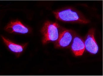 Synaptopodin Antibody / SYNPO