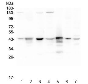 ADA Antibody / Adenosine deaminase
