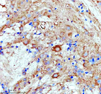 IHC staining of zebrafish Luteinizing hormone beta protein using Zebrafish Luteinizing hormone beta 