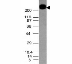Western blot testing of CD45RB antibody and Daudi lysate. Expected molecular weight: ~147/180-220 kD