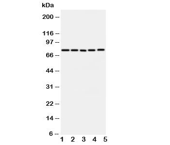 Western blot testing of ABCG1 antibody and Lane 1: U87; 2: SMMC-7721; 3: HeLa; 4: COLO320; 5: MCF-7 