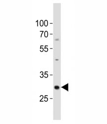Western blot analysis of lysate from mouse kidney tissue lysate using Hes1 antibody diluted at 1:500