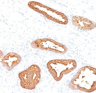 PSA / Prostate Specific Antigen Antibody