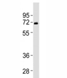 Western blot testing of SPHK2 antibody at 1:2000 dilution + human liver lysate. Predicted molecular 