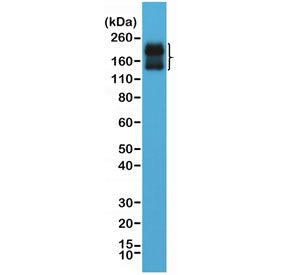 NCAM / CD56 Antibody