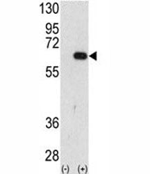 Western blot analysis of AMFR antibody and 293 cell lysate (2 ug/lane) either nontransfected (Lane 1