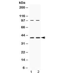 Western blot testing of human 1) HeLa and 2) U-2 OS cell lysate with RPSA antibody at 0.5ug/ml. Rout