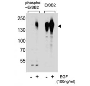 HER2 Antibody (ERBB2) (phospho-S1107)