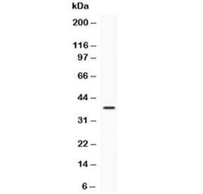 Western blot testing of recombinant human protein with IGFBP3 antibody at 0.5ug/ml. Expected molecul