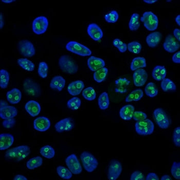 Immunofluorescent staining of PFA-fixed human HeLa cells with anti-Nucleolin antibody (clone SPM614,