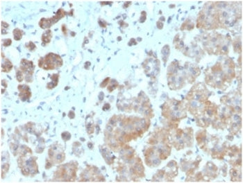 IL1 beta Antibody / IL1B