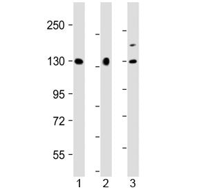 MGEA5 Antibody (N-Terminal Region)