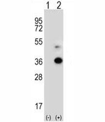 Western blot analysis of ANGPTL7 antibody and 293 cell lysate either nontransfected (Lane 1) or tran