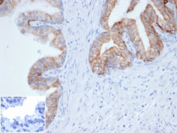 IHC staining of FFPE human prostate tissue with recombinant Pan Cytokeratin antibody (clone PCK/4933