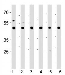 CTBP1 Antibody