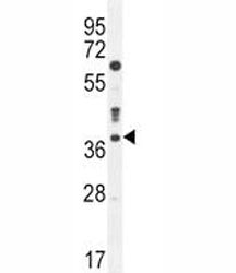 Caspase-3 Antibody