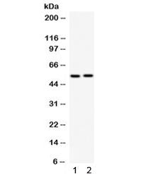 Western blot testing of 1) rat brain and 2) mouse brain lysate with GABRB3 antibody. Predicted/obser