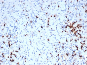 IHC staining of FFPE human tonsil tissue with recombinant Granzyme B antibody (clone GZMB/6530R). HI