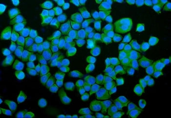 Immunofluorescent staining of FFPE human T-47D cells with PDI antibody (green) and DAPI nuclear stai