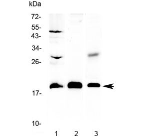 Western blot testing of 1) rat brain, 2) mouse NIH3T3 and 3) human COLO320 lysate with TMEM240 antib