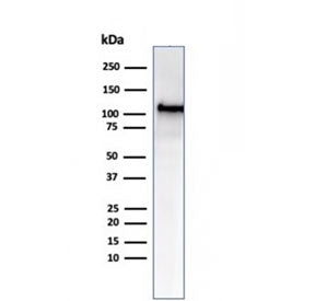 Western blot testing of human HCT-116 cell lysate using MSH2 antibody (clone MSH2/6549R). Expected m
