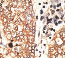 NRG2 Antibody